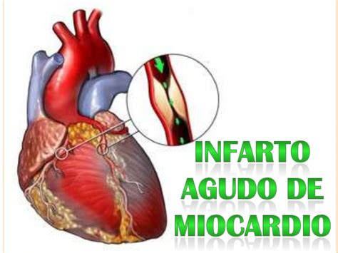 Fascinantes clasificacion hipertensión arterial tácticas